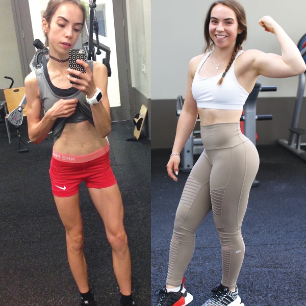 Kenzie at 90 lbs in January of 2016, Kenzie at 140 lbs in the summer of 201...